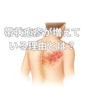 背中の右側に帯状疱疹の症状が現れている医療イラスト。神経に沿って赤く腫れた水疱が帯状に広がっており、黄色で神経の走行も示されている。