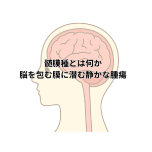 人の横顔のイラストに脳と脊髄が描かれており、脳を包む膜に潜む髄膜腫の存在を示す視覚的表現。