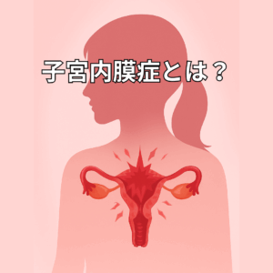 女性のシルエットの腹部に子宮と卵巣のイラストが重ねられ、子宮部分に赤い炎症を示すマークが描かれている。背景はピンクで、子宮内膜症による痛みや不調を象徴する医療的な図解。